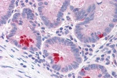 Immunohistochemistry-Paraffin: LRRN4 Antibody [NBP3-14394]